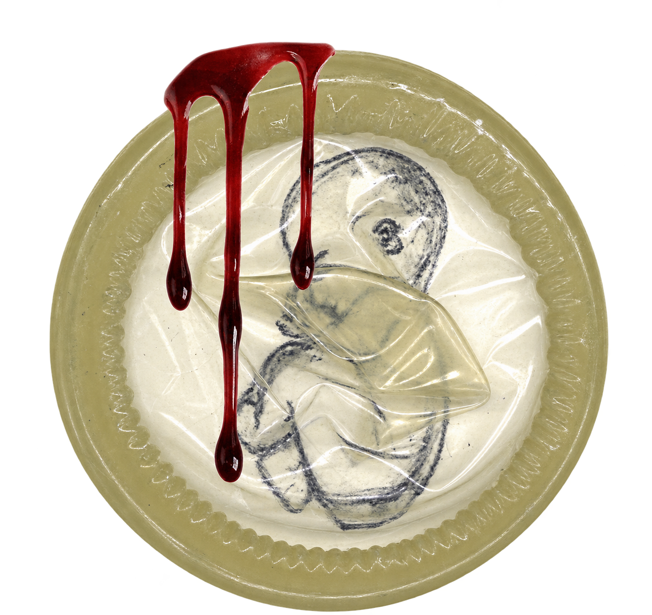 A condom holding a drawn foetal figure, with blood running across it